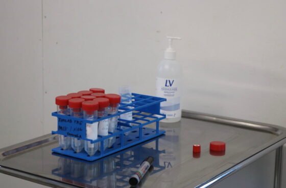 korona koronavirus nayte naytteet